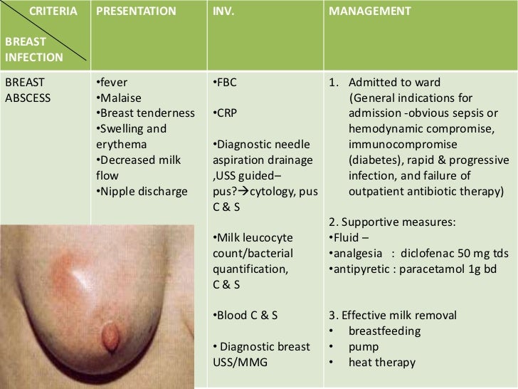 infection and breast Infection and breast
